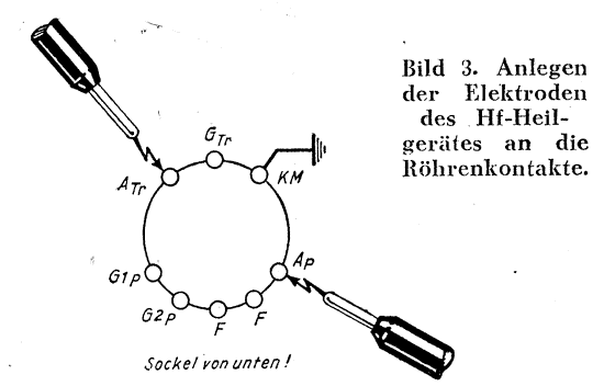 Wegbrennen von Feinschl�ssen bei einer VCL11